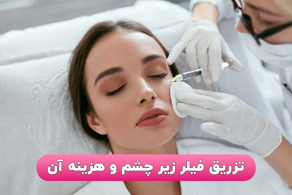 بهترین فیلر زیر چشم و هزینه آن